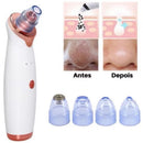 ￼Removedor Cravos e Espinhas Extrator de Cravos Sucção a Vácuo Aparelho Recarregável Sugador Remove Acne