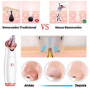 ￼Removedor Cravos e Espinhas Extrator de Cravos Sucção a Vácuo Aparelho Recarregável Sugador Remove Acne